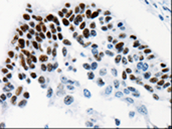 Rabbit Polyclonal Antibody to TGIF2LX