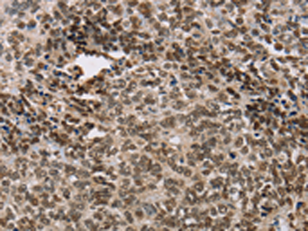 Rabbit Polyclonal Antibody to ACVR1B