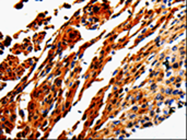 Rabbit Polyclonal Antibody to ADD1