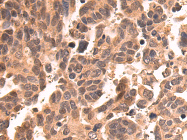 Rabbit Polyclonal Antibody to AKT1