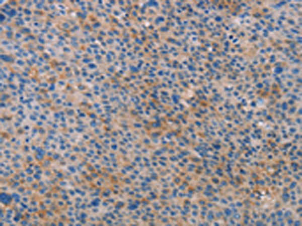 Rabbit Polyclonal Antibody to ALOX15B