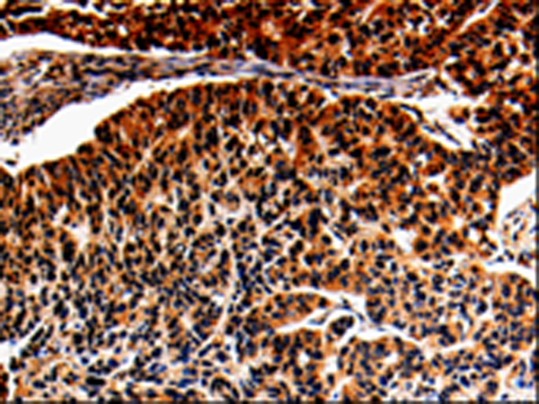 Rabbit Polyclonal Antibody to ALOX5