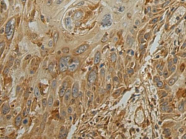 Rabbit Polyclonal Antibody to ALPL