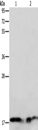 Rabbit Polyclonal Antibody to ANG