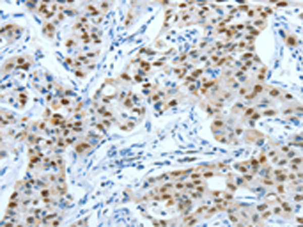 Rabbit Polyclonal Antibody to JUN