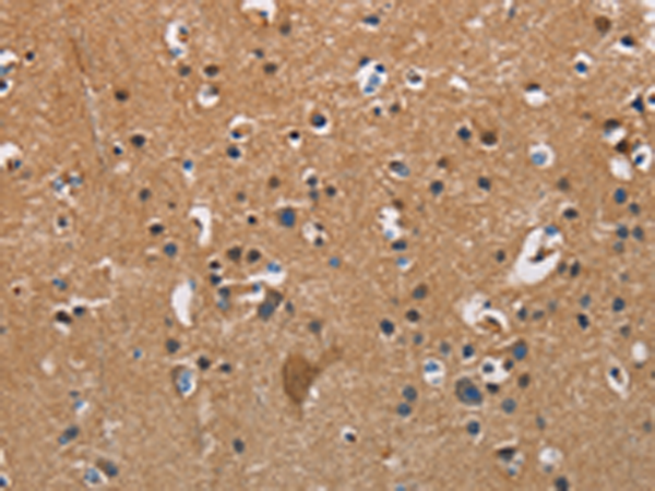 Rabbit Polyclonal Antibody to APOA1
