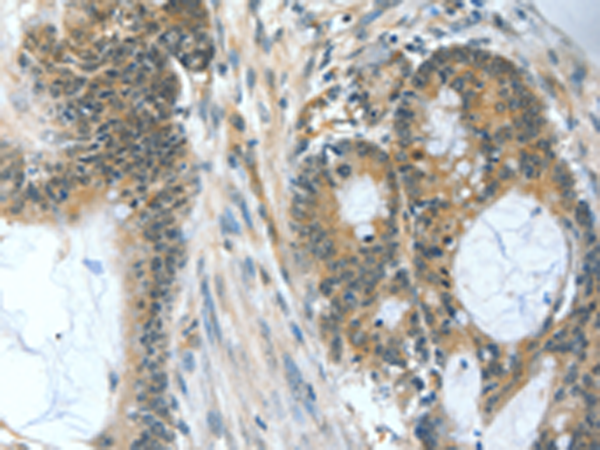 Rabbit Polyclonal Antibody to BAD
