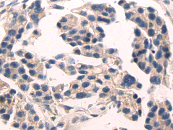 Rabbit Polyclonal Antibody to CASP7
