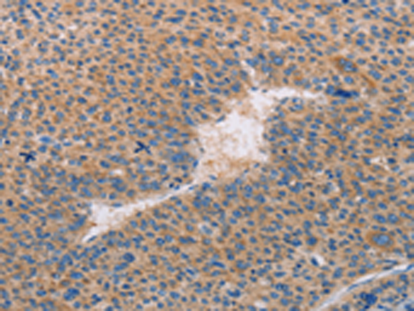 Rabbit Polyclonal Antibody to CASP10
