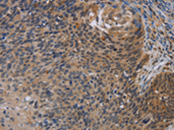 Rabbit Polyclonal Antibody to STAT1