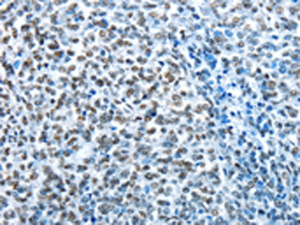 Rabbit Polyclonal Antibody to CREB1