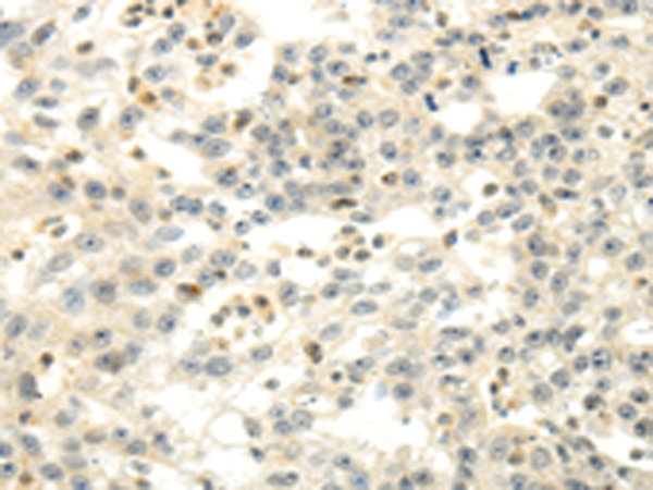 Rabbit Polyclonal Antibody to CDKN1A