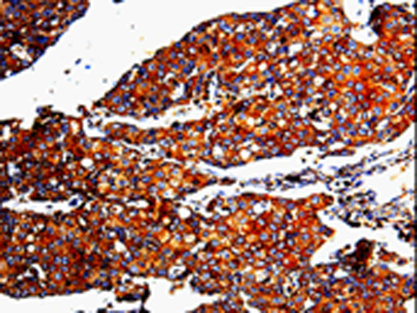 Rabbit Polyclonal Antibody to MMP3
