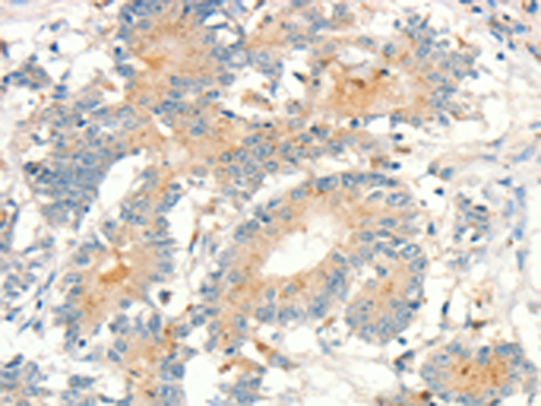 Rabbit Polyclonal Antibody to MMP9