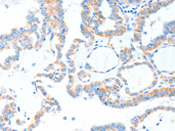Rabbit Polyclonal Antibody to TLR2