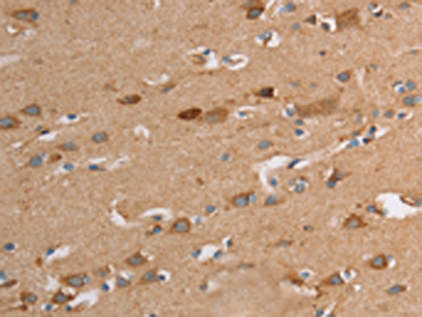 Rabbit Polyclonal Antibody to TLR8