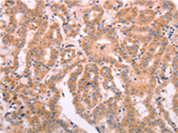 Rabbit Polyclonal Antibody to LEP