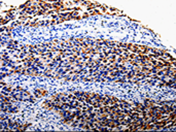 Rabbit Polyclonal Antibody to COX10
