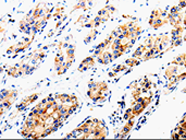 Rabbit Polyclonal Antibody to COX16