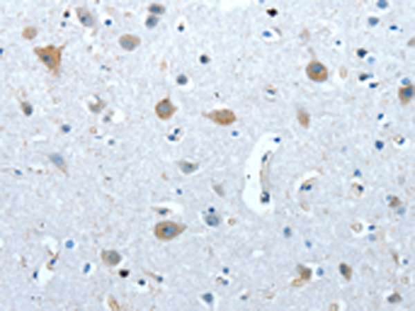 Rabbit Polyclonal Antibody to COX7B2