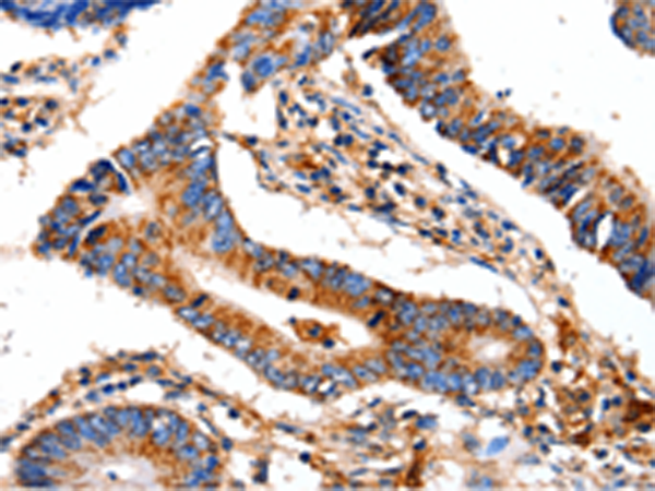 Rabbit Polyclonal Antibody to COX8A