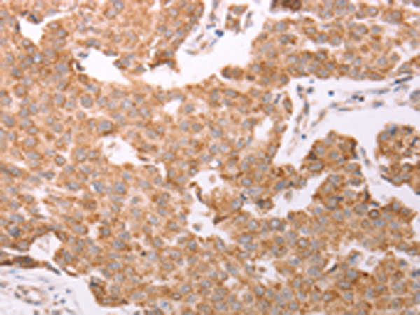 Rabbit Polyclonal Antibody to SMAD5