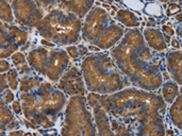 Rabbit Polyclonal Antibody to SNCG