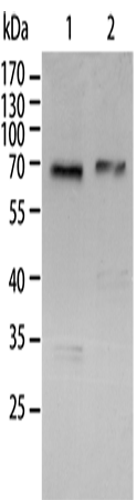 Rabbit Polyclonal Antibody to RELA