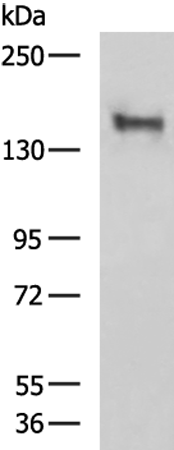 Rabbit Polyclonal Antibody to TONSL