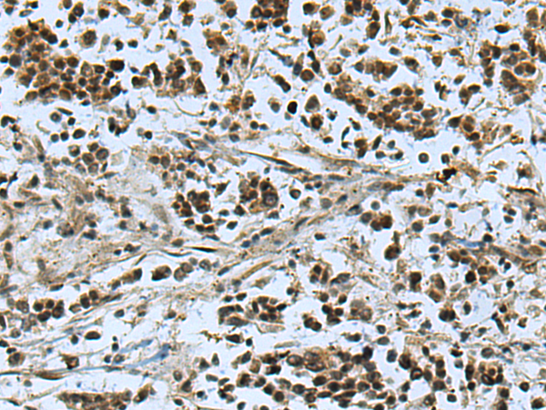 Rabbit Polyclonal Antibody to BCOR