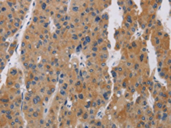 Rabbit Polyclonal Antibody to BCL2L12