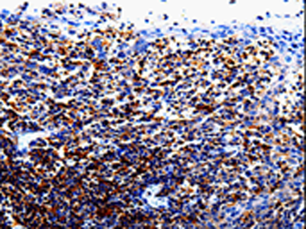Rabbit Polyclonal Antibody to IL10RA