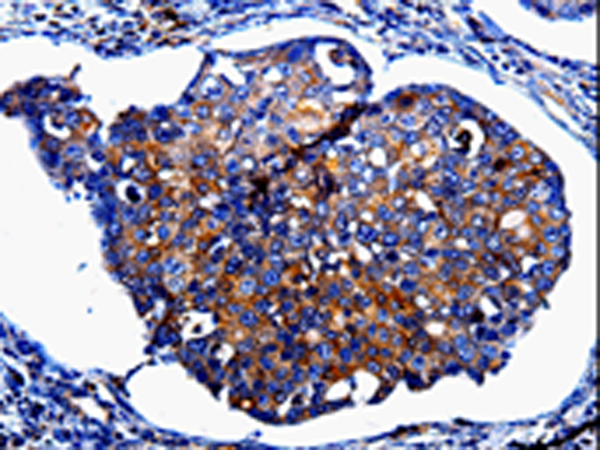 Rabbit Polyclonal Antibody to IL10RB