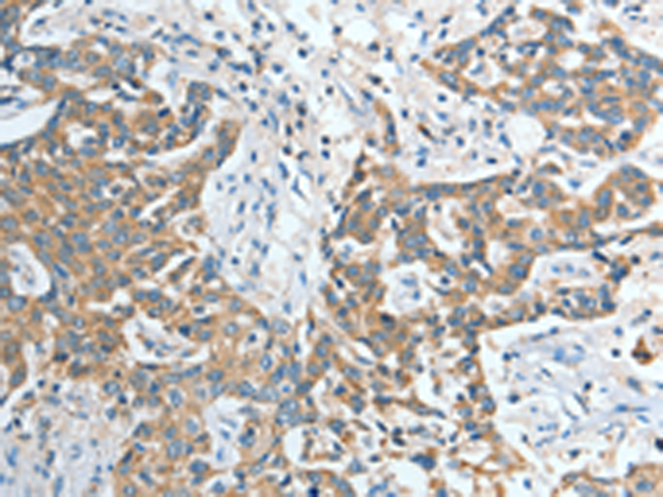 Rabbit Polyclonal Antibody to IL12RB1