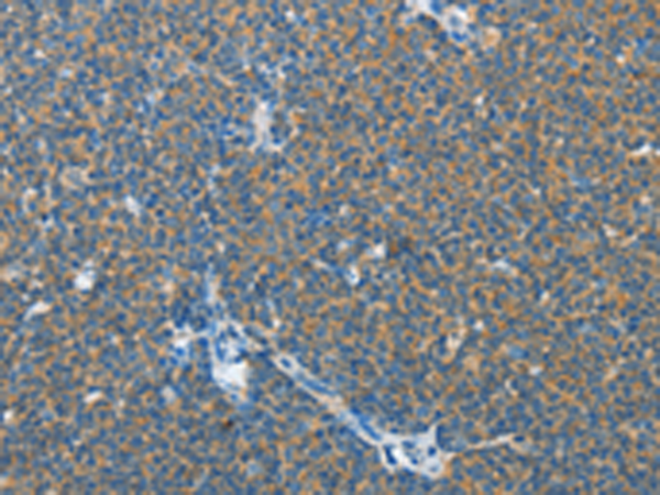 Rabbit Polyclonal Antibody to IL13RA2