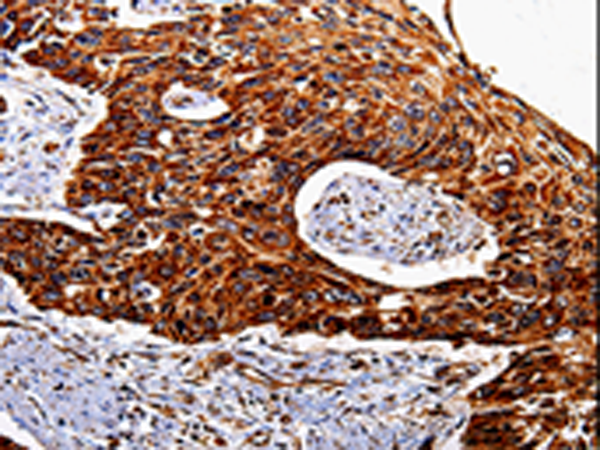 Rabbit Polyclonal Antibody to IL17RC