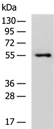 Rabbit Polyclonal Antibody to IL18R1
