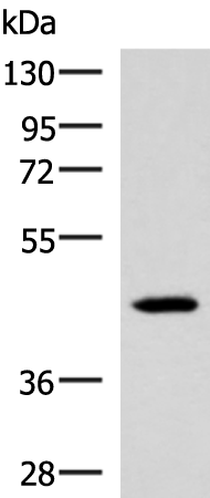 Rabbit Polyclonal Antibody to IL18BP