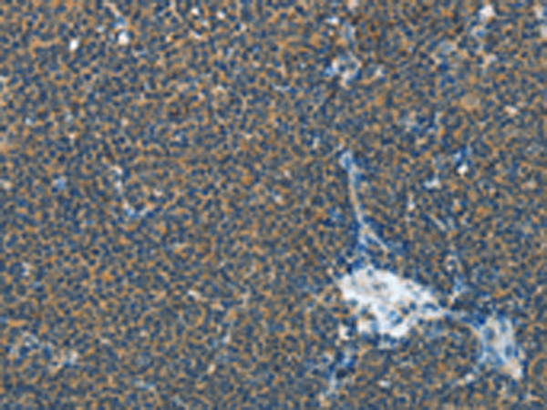 Rabbit Polyclonal Antibody to IL1R1