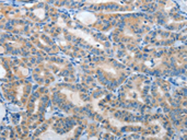 Rabbit Polyclonal Antibody to IL21R