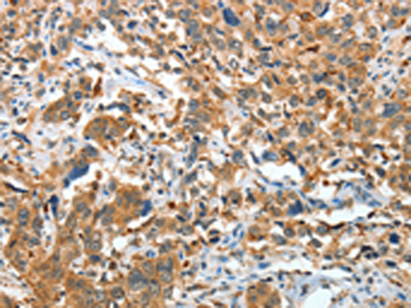 Rabbit Polyclonal Antibody to IL22RA1