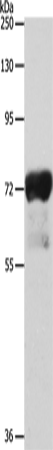 Rabbit Polyclonal Antibody to IL23R