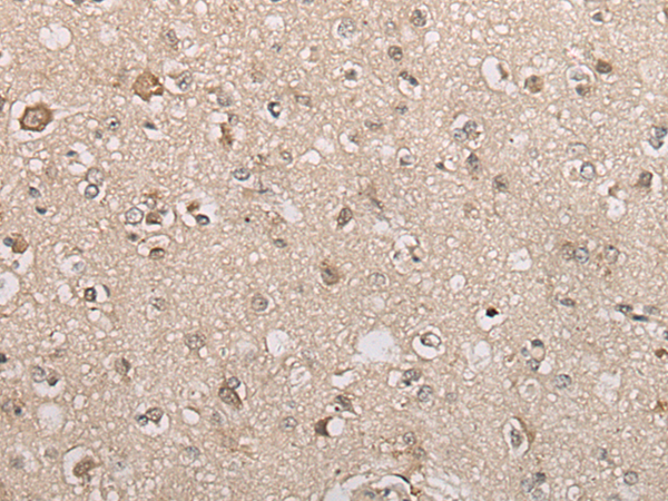 Rabbit Polyclonal Antibody to AAK1