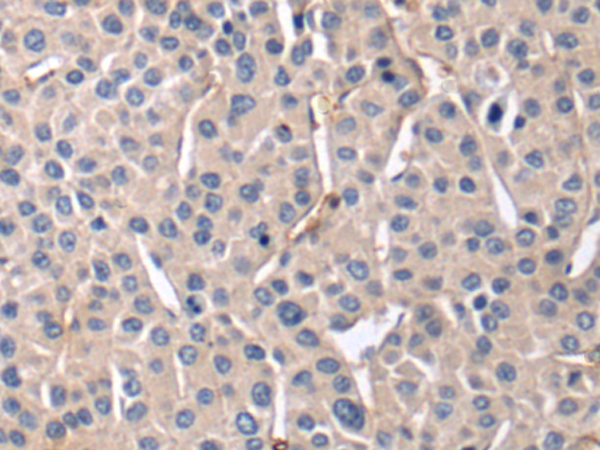 Rabbit Polyclonal Antibody to ABL1