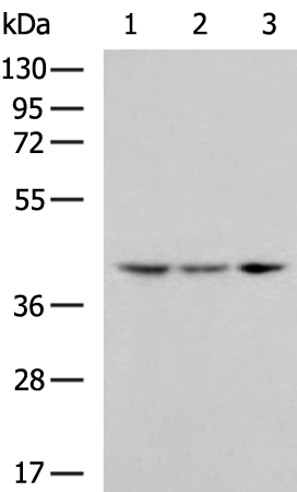Rabbit Polyclonal Antibody to AGTR1