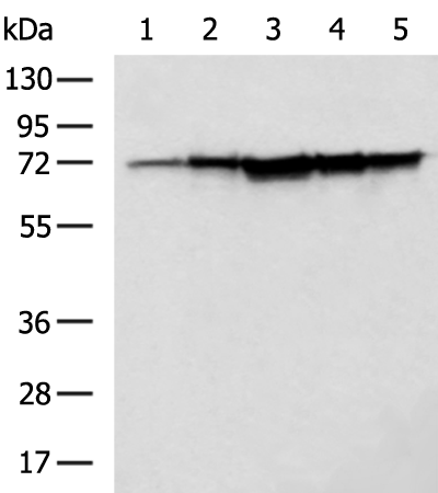Rabbit Polyclonal Antibody to AIFM1