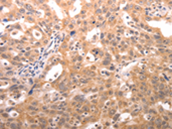 Rabbit Polyclonal Antibody to SERPINC1
