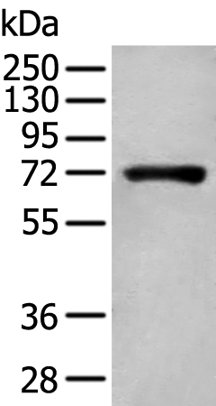 Rabbit Polyclonal Antibody to ANGPT1