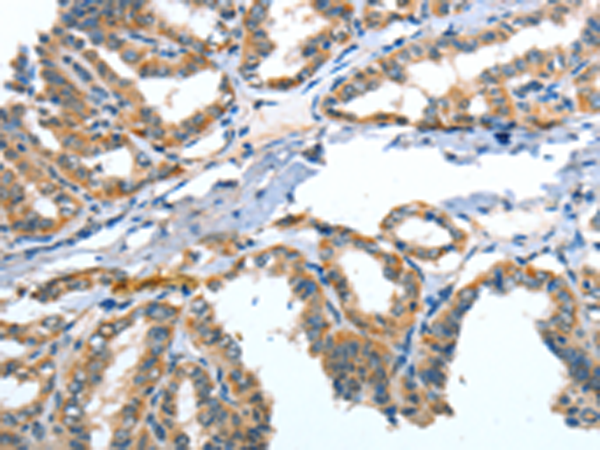 Rabbit Polyclonal Antibody to ANGPT2