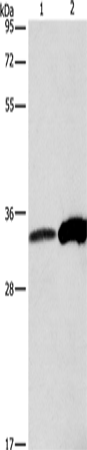 Rabbit Polyclonal Antibody to ANXA4